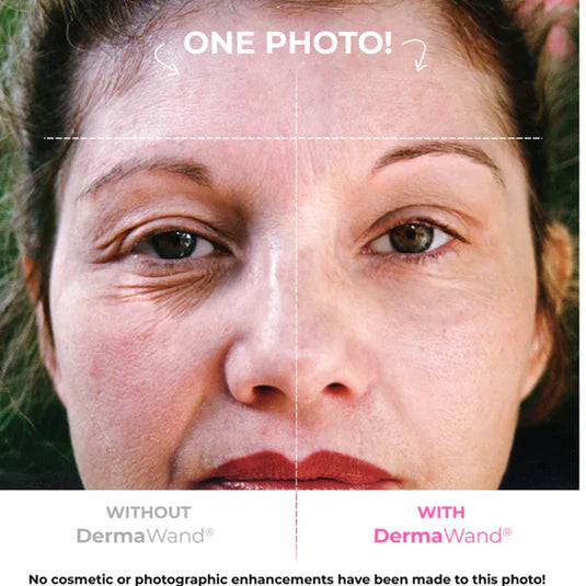 Derma Rewind Jennie Pinky – DermaWand